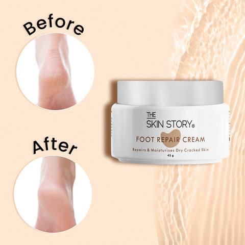 The Skin Story Foot Cream for Cracked Heels | Dry Feet | Repair Cream | Enriched with Shea Butter & Cocoa Butter | 50g